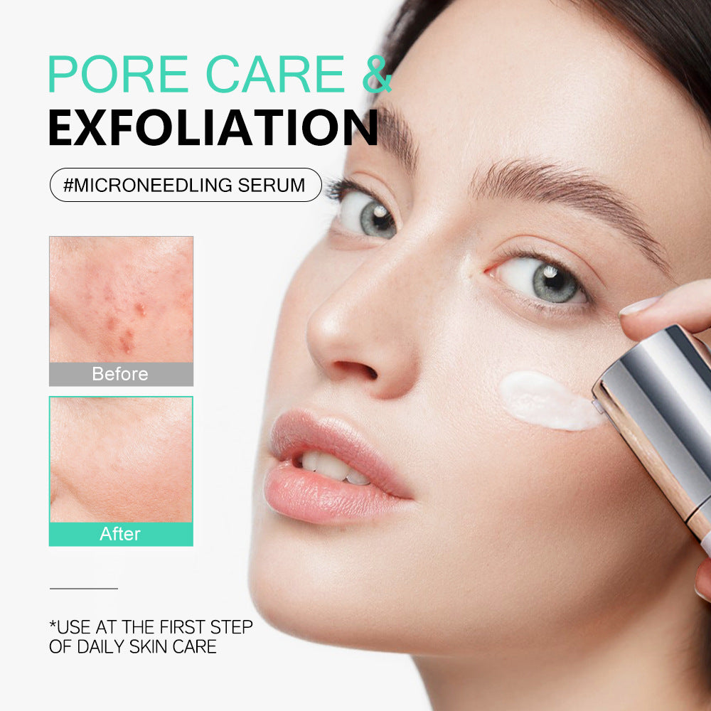 Centella Asiatica Microneedle Serum Soothes Hydrates And Moisturizes