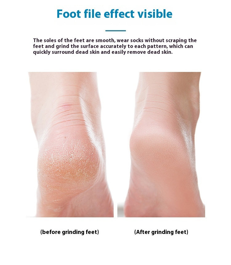 Mango-shaped Exfoliating Scrub Artifact Pedicure Device