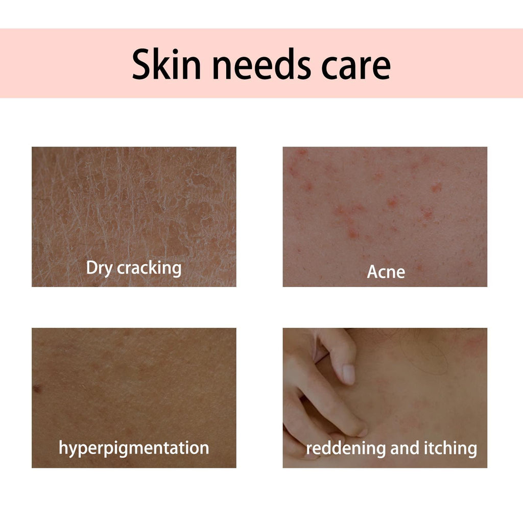 Peach Scented Body Oil Hydrating, Moisturizing, And Firming Massage Oil