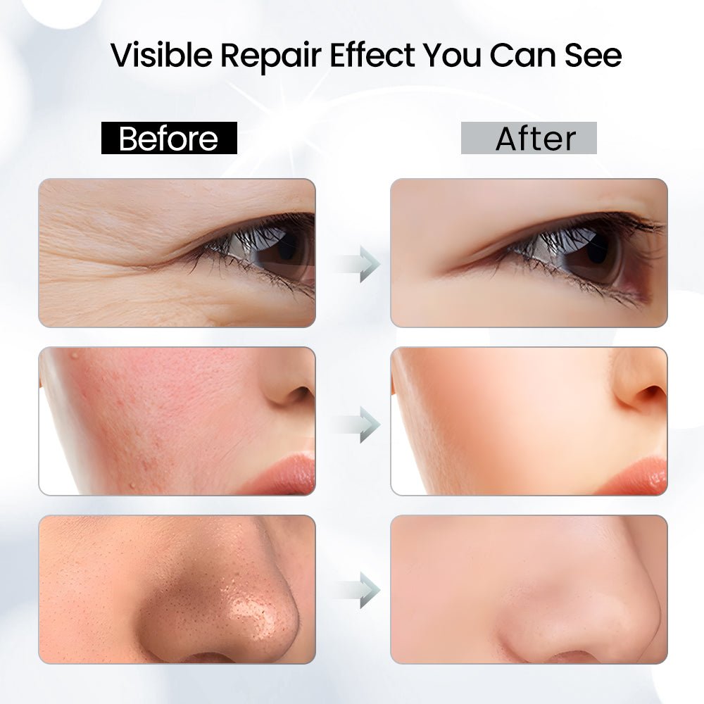 Shape Tactics 7-Color LED Light Therapy Mask