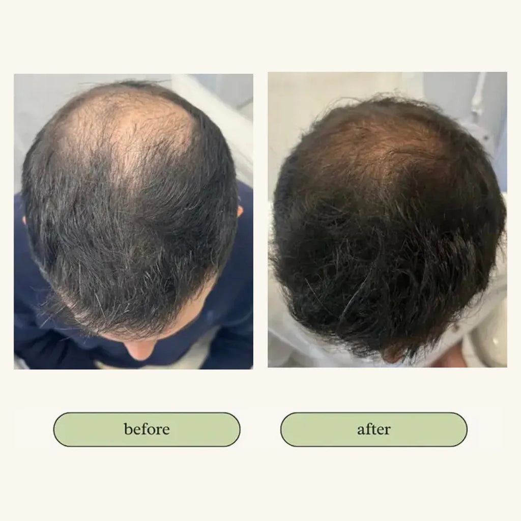 Vital Hair Trio Bundle