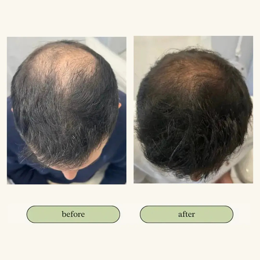 Vital Hair Trio Bundle