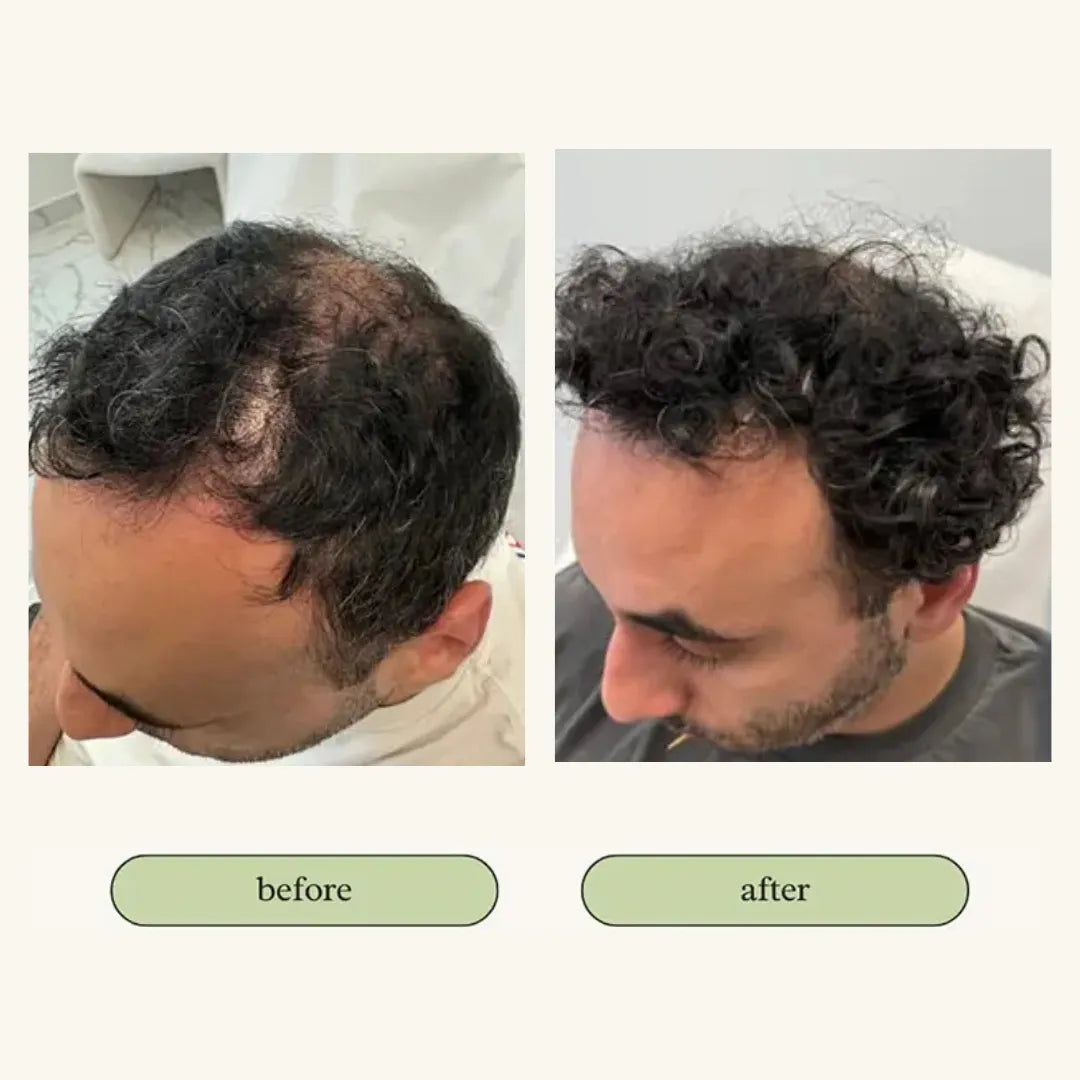 Vital Hair Trio Bundle